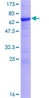 12.5% SDS-PAGE Stained with Coomassie Blue.